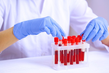 Woman working with blood samples in laboratory, closeup