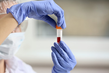 Obraz premium Medical professional in blue gloves holding blood sample vial for laboratory testing and diagnosis, this action is crucial for accurate diagnosis, disease monitoring
