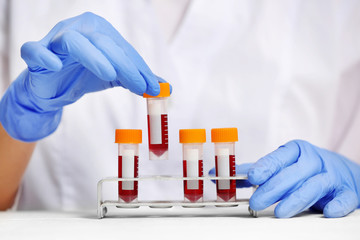 Woman working with blood samples in laboratory, closeup