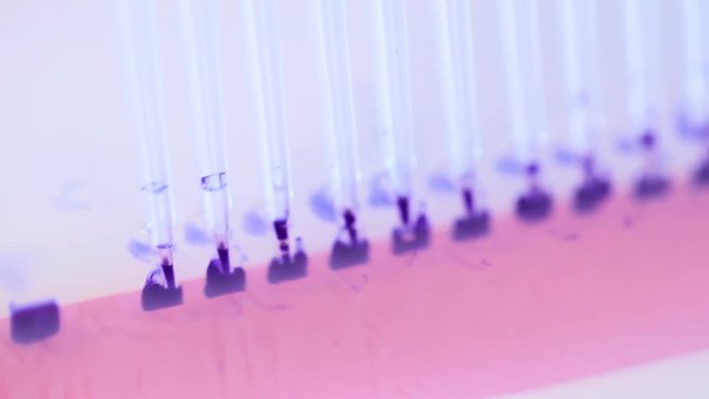 Analyse m&eacute;dical 