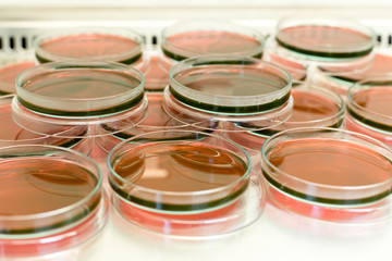 Eosin Methylene Blue (EMB) Agar for culture medium for Inoculum tests in Biological safety cabinets lab.