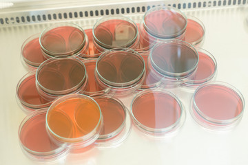 Eosin Methylene Blue (EMB) Agar for culture medium for Inoculum tests in Biological safety cabinets lab.