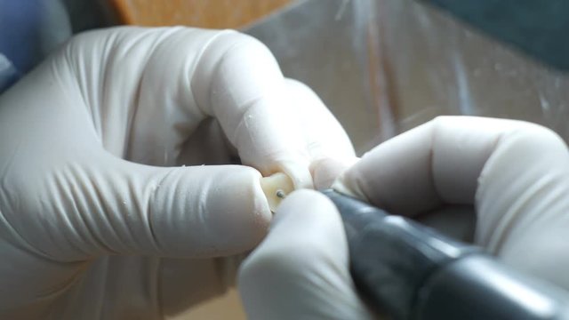 Closeup of a dental technician making of denture in a dental lab