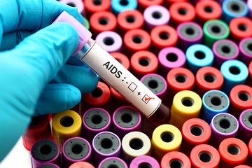 Naklejka premium AIDS positive