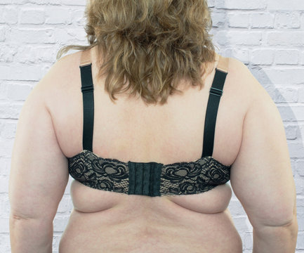 Frau zeigt ihre Cellulite