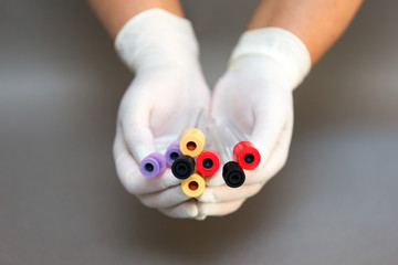 Blood tests