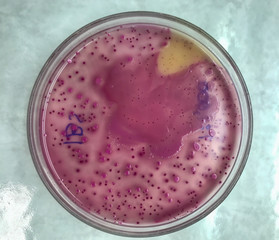 microbiology in laboratory