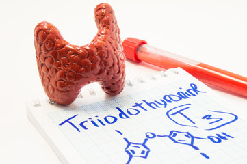 Thyroid gland hormone Triiodothyronine. Model of thyroid, laboratory test tube with blood and notebook inscribed with Triiodothyronine T3 with it chemical formula. Concept for hormonal thyroid disease