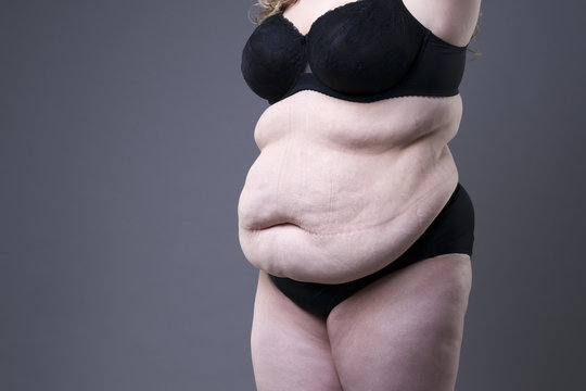 Plus size model in black lingerie, overweight female body, fat woman with stretch marks on gray background