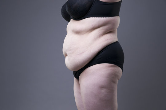 Plus Size Model In Black Lingerie, Overweight Female Body, Fat Woman With Stretch Marks On Gray Background