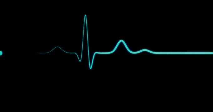 EKG Line / EKG Monitor / EKG Machine / Heart Health. Blue ECG monitor shows the heart beat. The heart stops for three seconds and starts again.