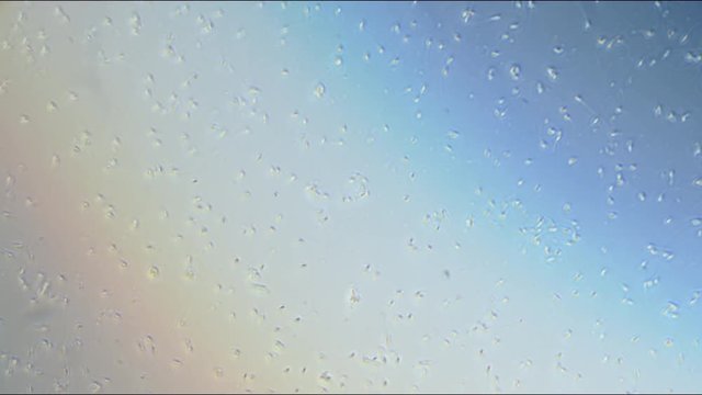 Healthy human sperm microscope with no polarization filter