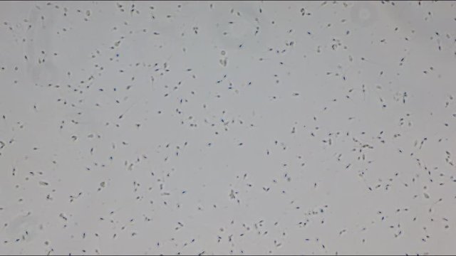 Healthy human sperm through microscope in focus