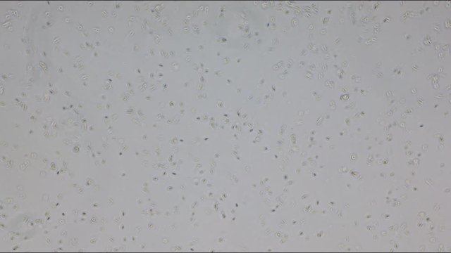 Healthy human sperm through microscope