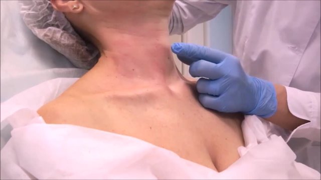 Doctor dermatologist cosmetologist performs botulinum toxin injections for neck and decoltè rejuvenation