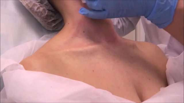 Doctor dermatologist cosmetologist performs botulinum toxin injections for neck and decoltè rejuvenation at beauty clinic