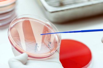 Close up the media plate on hand medical technicians working on bacterial culture and drug...