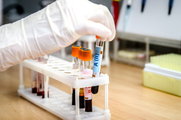 The doctor pulls out the tube with the second group of blood from a tripod.