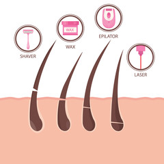 Modern vector illustration of different methods of hair removal. Types of epilation.