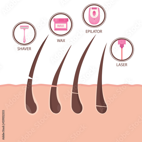 "Modern vector illustration of different methods of hair removal. Types