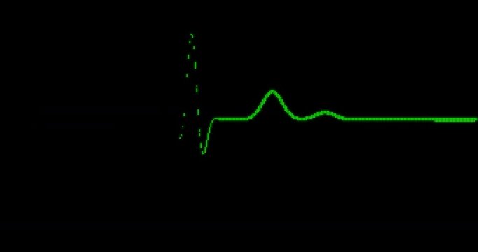 EKG Line / EKG Monitor / EKG Machine / Heart Health. Green digital pixelated ECG monitor shows the heart beat. The heart stops for three seconds and starts again.