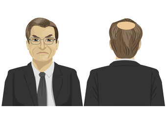 front and back view of sad mature businessman with bald problem