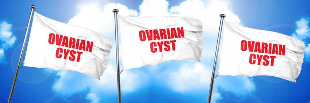 ovarian cyst, 3D rendering, triple flags