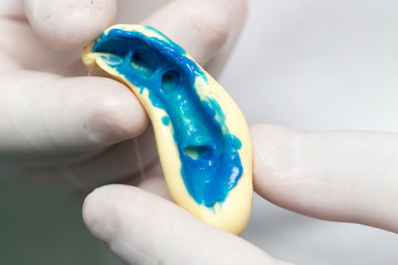 doctor makes a plastic prosthetic dentistry