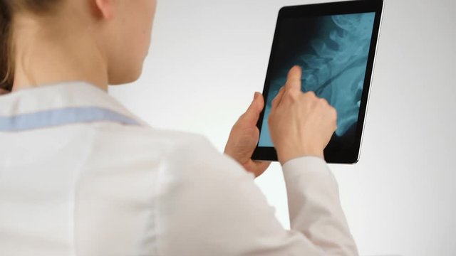 Female doctor holding digital computer, analyzing neck roentgen. Health care concept.   