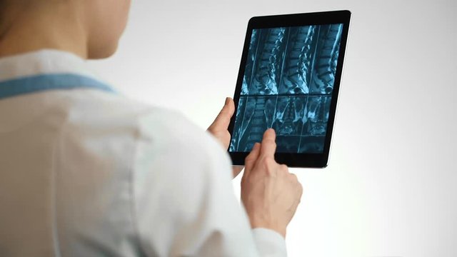 Woman doctor holding digital tablet, examining spine X-ray of a patient.