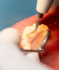 dental treatment in dentistry