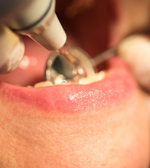 dental treatment in dentistry