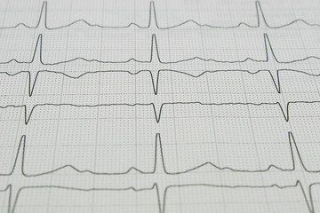 cardiogram as background