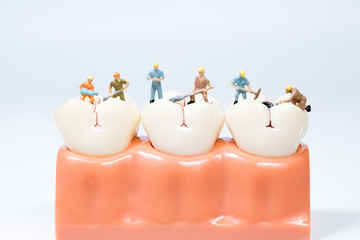miniature people clean tooth model,medical concept