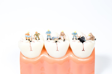 miniature people clean tooth model,medical concept