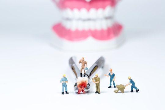 miniature people clean tooth model,medical concept