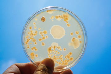Colony of bacteria in culture medium plate