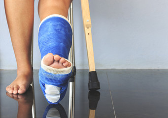 broken leg in a plaster cast with soft-focus in the background. over light  Stock Photo | Adobe Stock