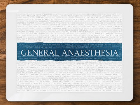 General Anaesthesia