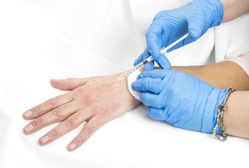 Mesotherapy process on a female hand in clinic 