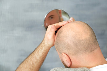 Adult man with hair loss problem looking in mirror at home