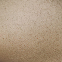 Human skin
