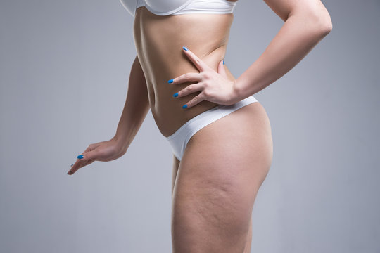 Woman in white underwear on gray background, cellulite on female body