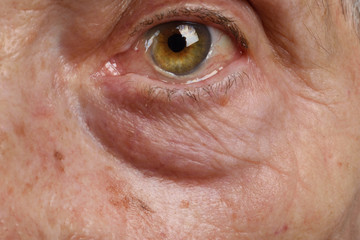 Fototapeta premium Bags in the eyes of an older woman