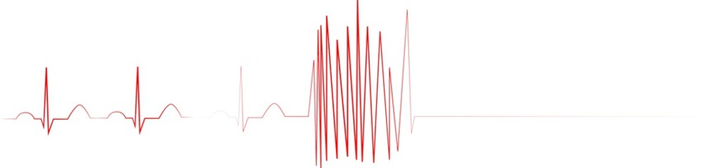 EKG mit Herz - obrazy, fototapety, plakaty