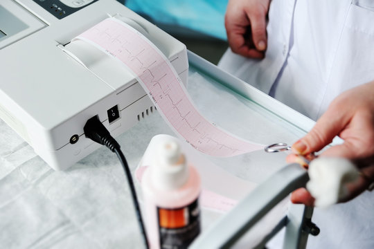 Electrocardiogram, ecg in hand. Clinic cardiology heart rhythm and pulse test closeup. Cardiogram printout.