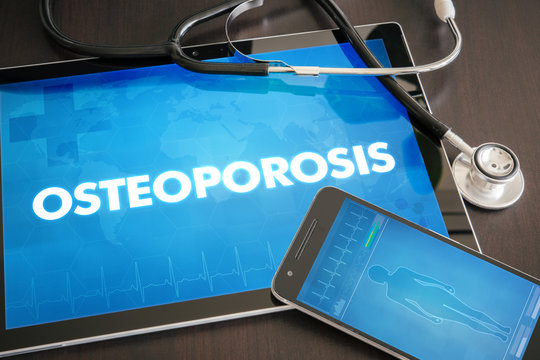 Osteoporosis (endocrine Disease) Diagnosis Medical Concept On Tablet Screen With Stethoscope