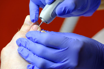 Pedicure specialist works with the patient in clinic