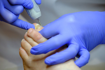 Obraz premium Pedicure specialist works with the patient in clinic