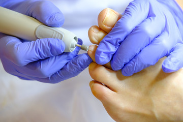 Pedicure specialist works with the patient in clinic - obrazy, fototapety, plakaty